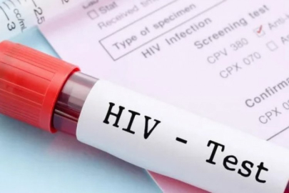 AIDS nedir? AIDS nasıl bulaşır?